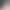 Hinata loop 2